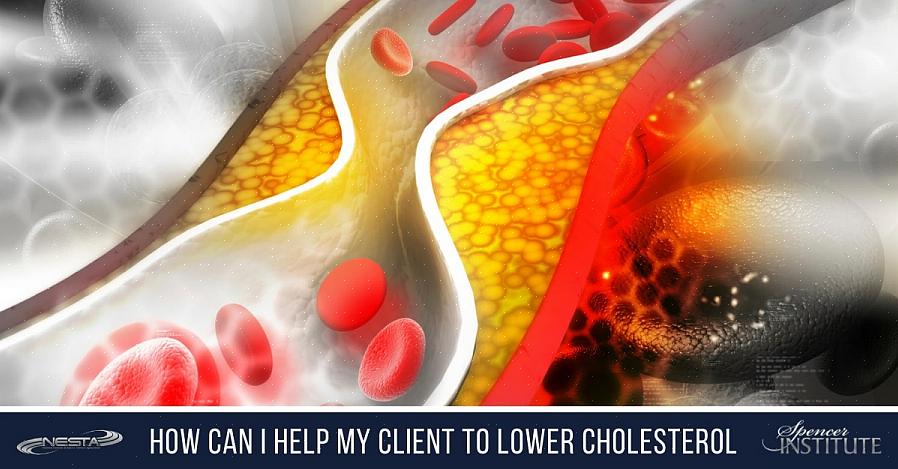 Tässä on useita tapoja alentaa kolesterolitasoa sekä elintarvikkeita