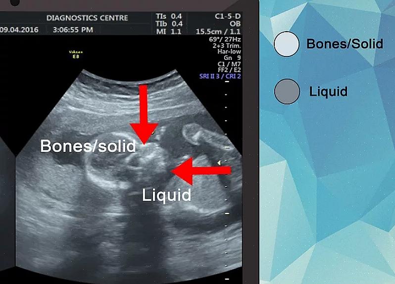 Jos haluat oppia tulemaan ultraäänitutkijaksi