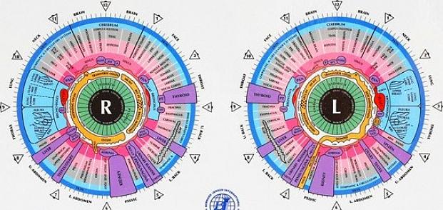 Joka diagnosoi sairaudet potilaan iiriksen merkinnöistä